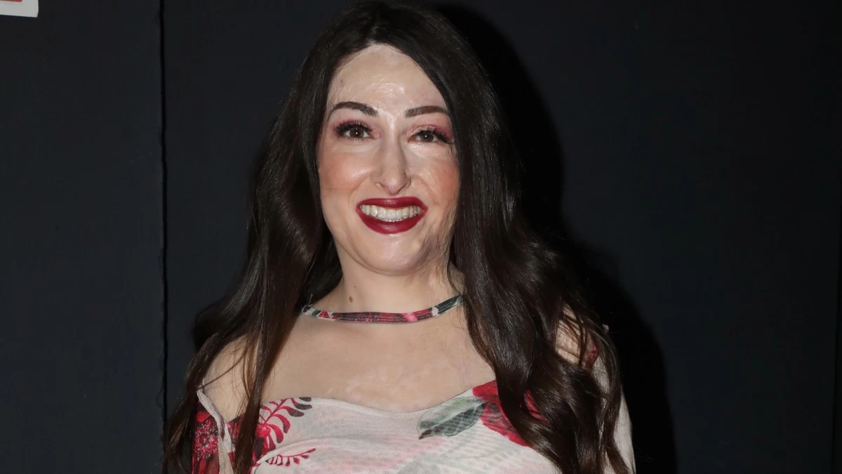 Ιωάννα Παλιοσπύρου: «Η γυναίκα που μου πέταξε το βιτριόλι λερώνει την ψυχή μου» - Τι δηλώνει 4 χρόνια μετά την επίθεση