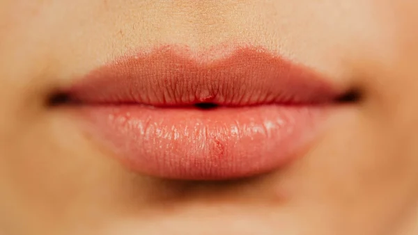 Ζουμερά χείλη: Θα τα αποκτήσεις με τον πιο εύκολο τρόπο - Ιδανικός για ηλικίες άνω των 40!