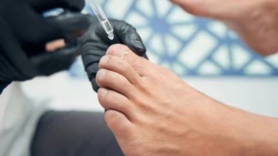 Αυτό το συστατικό θα σε απαλλάξει από τις σκασμένες φτέρνες