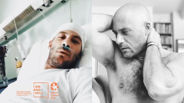 Ο Αντίνοος Αλμπάνης σε διάφορες φάσεις κάτα την διάρκεια που περνούσε καρκίνο