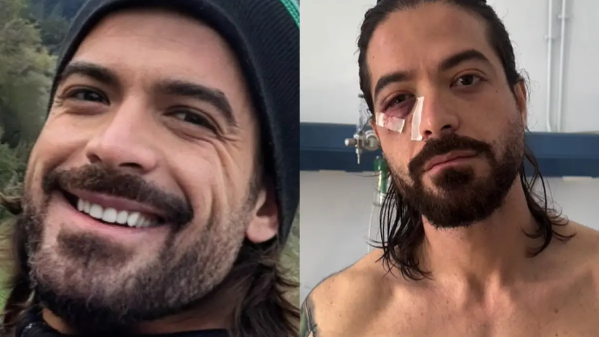 Άρης Μουγκοπέτρος