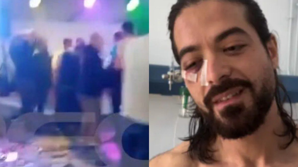 Ο Άρης Μουγκοπέτρος μετά το ατύχημα με την κροτίδα