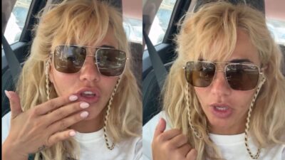 Η Κόνι Μεταξά για το υαλουρονικό που αφαίρεσε από τα χείλη της