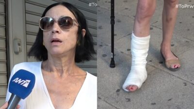 Η Έλενα Τοπαλίδου με σπασμένο πόδι