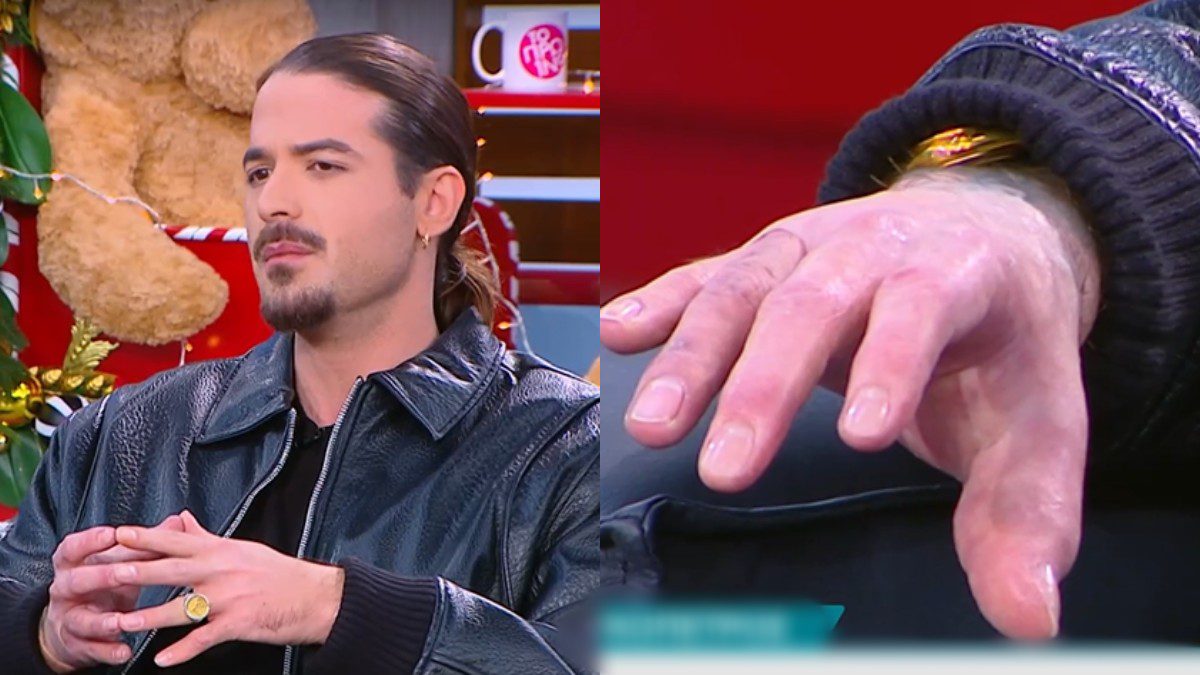 Άρης Μουγκοπέτρος