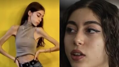 Η Έλλη για τη νευρική ανορεξία